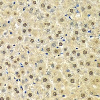 Anti-SPHK1 Antibody