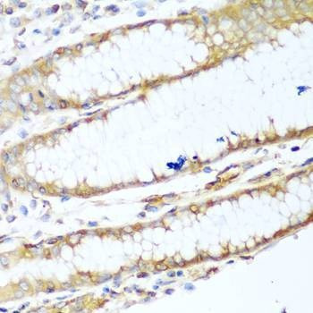 Anti-MYH9 Antibody