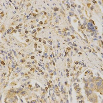 Anti-BAK1 Antibody