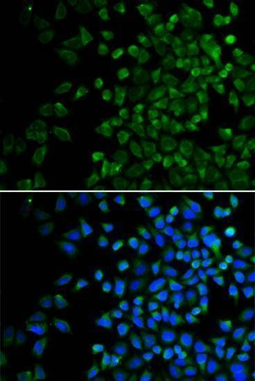 Anti-BAK1 Antibody