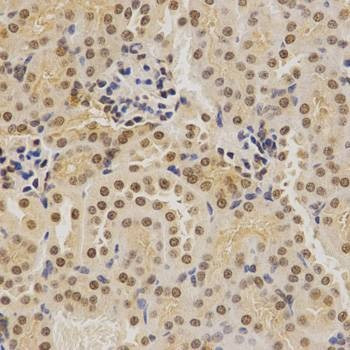 Anti-BMI1 Antibody