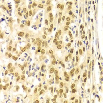 Anti-BMI1 Antibody