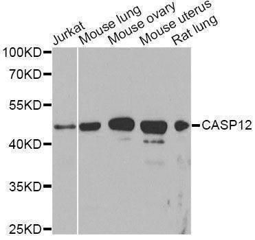 Anti-CASP12 Antibody