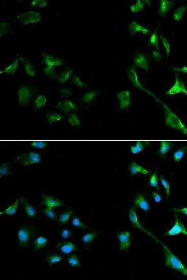 Anti-MAPK1 Antibody