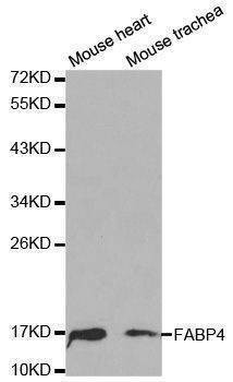 Anti-FABP4 Antibody
