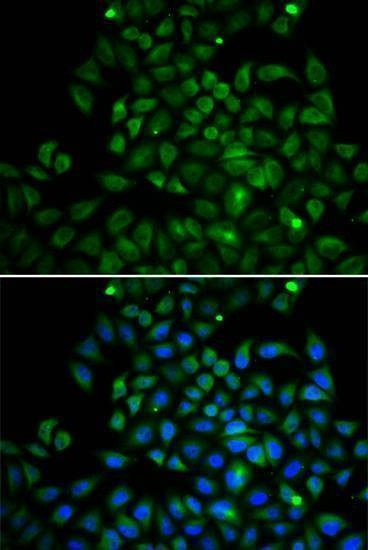 Anti-FABP4 Antibody