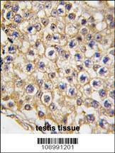 Anti-Mouse TRPV3 (N-term) Antibody