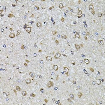 Anti-FGF2 Antibody
