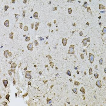 Anti-FGF2 Antibody