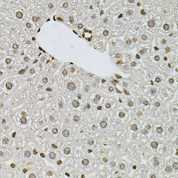 Anti-FGF2 Antibody