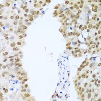 Anti-HDAC1 Antibody
