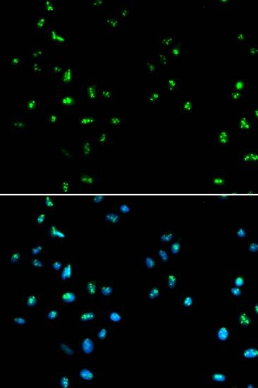 Anti-HDAC4 Antibody