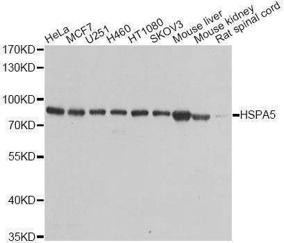 Anti-HSPA5 Antibody