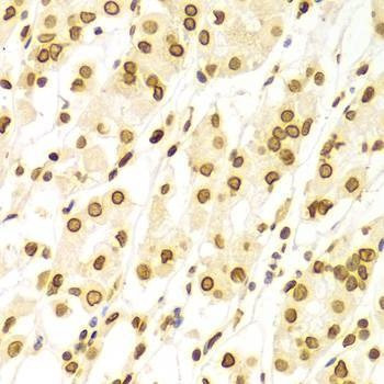 Anti-LMNA Antibody