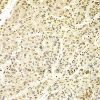 Anti-LMNA Antibody