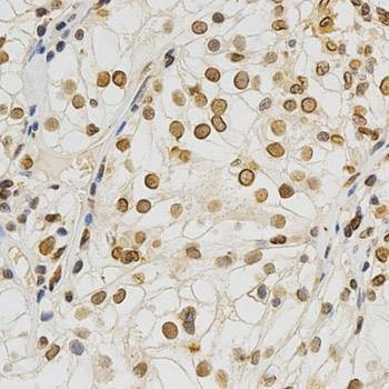 Anti-LMNA Antibody
