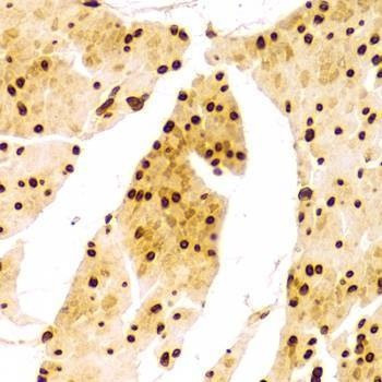 Anti-LMNA Antibody