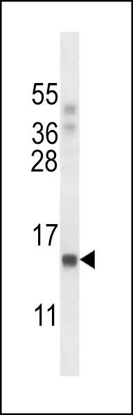 Anti-POLR2J (C-term) Antibody