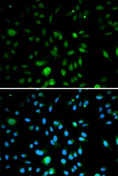 Anti-CDKN2A Antibody