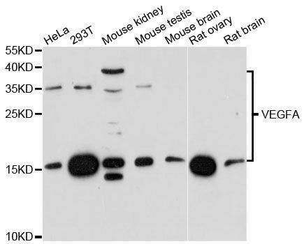 Anti-VEGFA Antibody