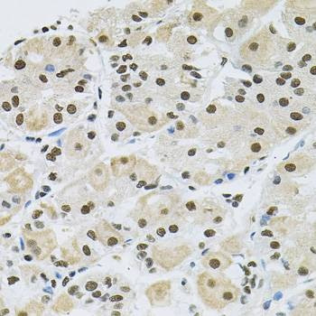 Anti-MAPK8 Antibody