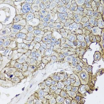 Anti-CD44 Antibody