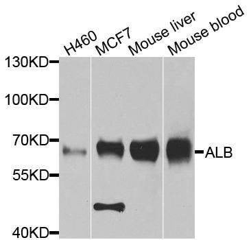 Anti-ALB Antibody