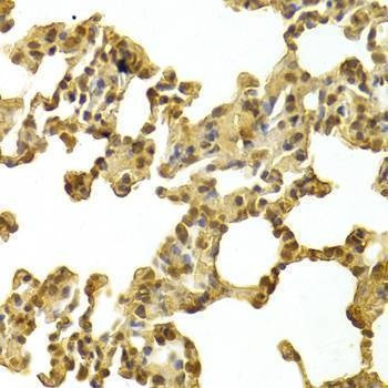 Anti-CDK4 Antibody
