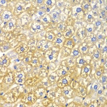 Anti-FASN Antibody