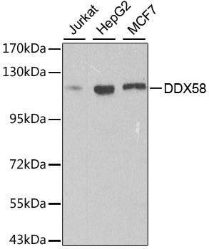 Anti-DDX58 Antibody