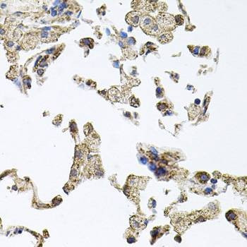 Anti-PKN1 Antibody
