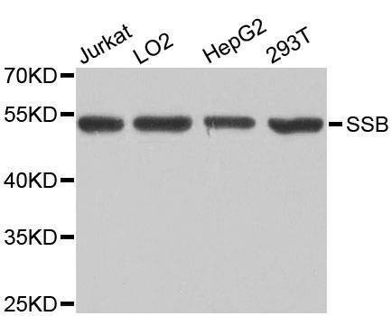 Anti-SSB Antibody
