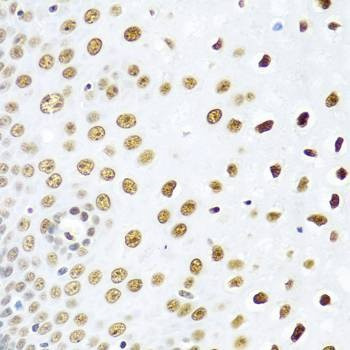 Anti-SSB Antibody