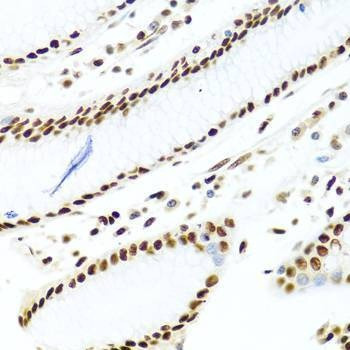 Anti-SSB Antibody