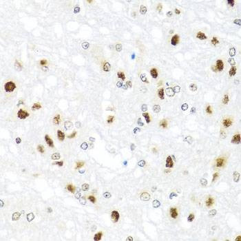 Anti-GATA2 Antibody
