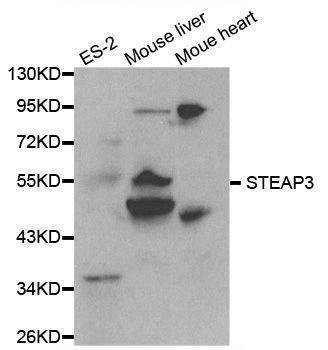 Anti-STEAP3 Antibody