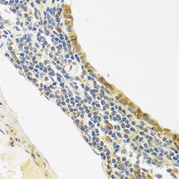 Anti-EDN1 Antibody