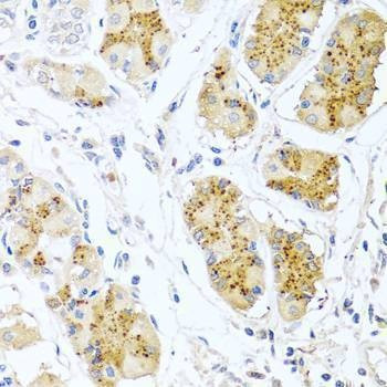 Anti-EDN1 Antibody