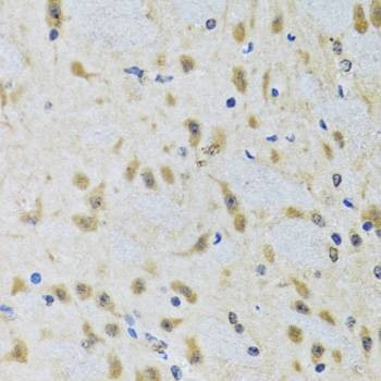 Anti-ATG7 Antibody