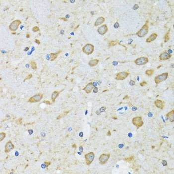Anti-ATG7 Antibody