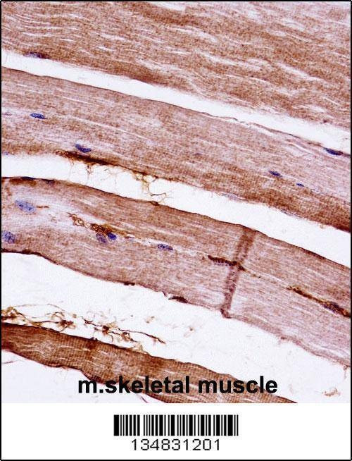 Anti-Mouse Mapkapk3 (N-term) Antibody