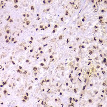 Anti-XRCC6 Antibody