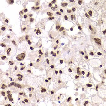 Anti-XRCC6 Antibody