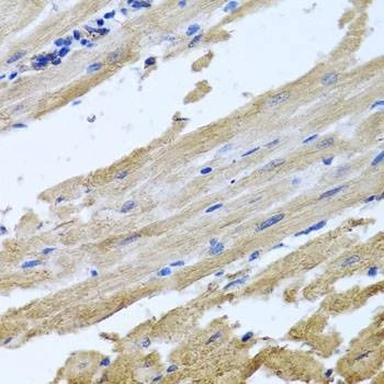 Anti-NSF Antibody