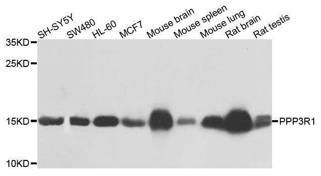 Anti-PPP3R1 Antibody