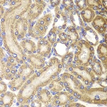 Anti-HSPD1 Antibody