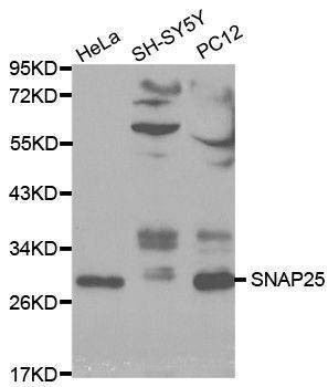 Anti-SNAP25 Antibody