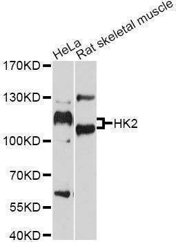 Anti-HK2 Antibody