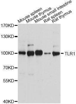 Anti-TLR1 Antibody