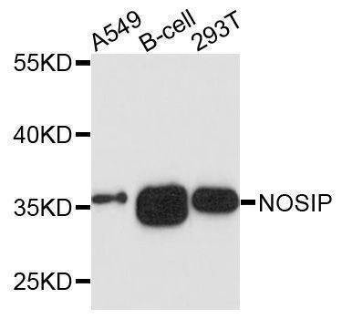 Anti-NOSIP Antibody